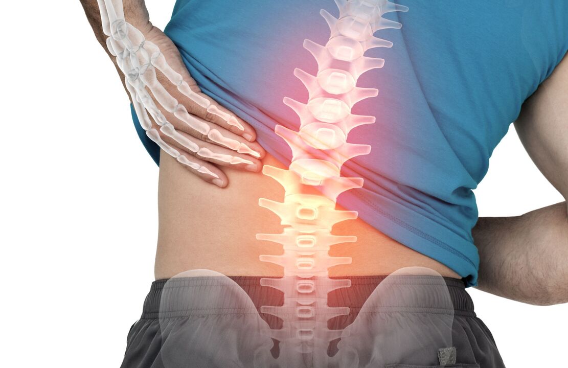 Il pericolo di ostecondosi del lombare