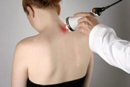 Trattamento dell'osteocondosi cervicale con terapia laser